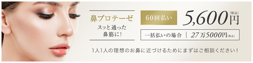 【鼻プロテーゼ スッと通った鼻筋に！】[60回払い]5,600円（税込）一括払いの場合27万5000円（税込）1人1人の理想のお鼻に近づけるためにまずはご相談ください！