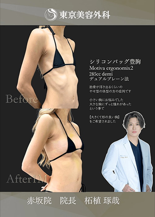 柘植医師インスタ