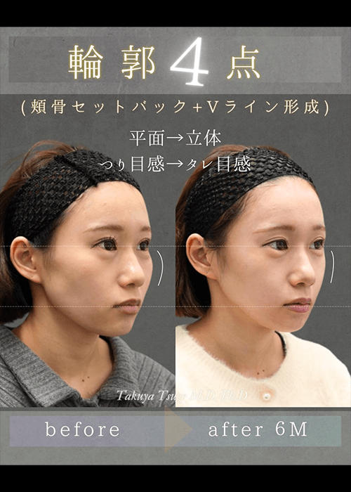 柘植医師インスタ