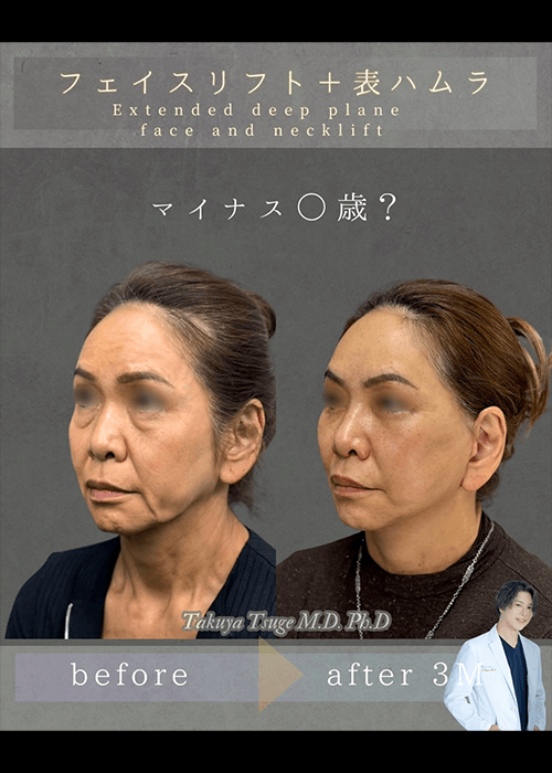 柘植医師インスタ