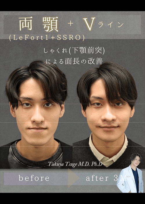 柘植医師インスタ