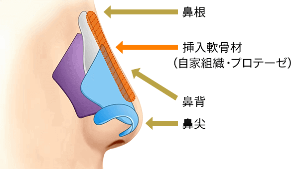 オープン法・クローズ法の術式