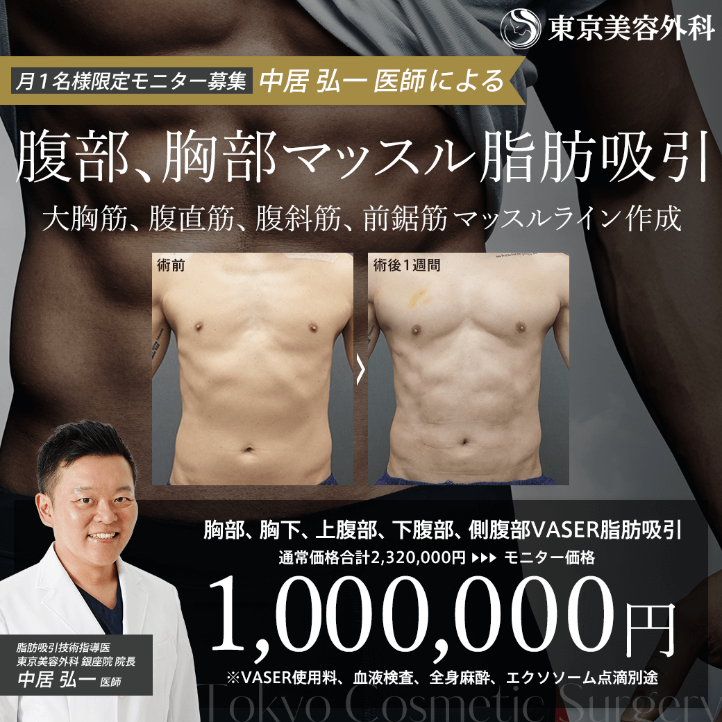 腹部マッスル脂肪吸引モニター募集