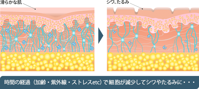 滑らかな肌とシワやたるみがある肌の構造