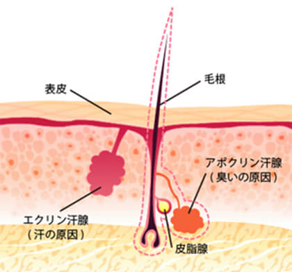 ワキガと多汗症の違い